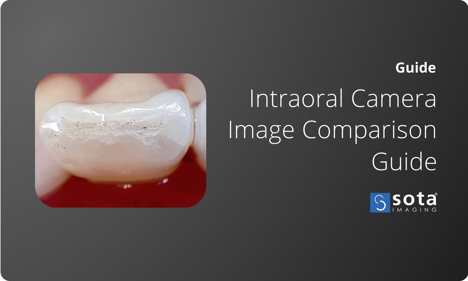 Intraoral Camera Image Comparison Guide